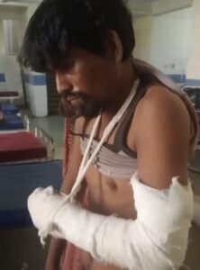 लोकतंत्र शर्मसार: छुट्टी मांगी तो आदिवासी मजदूर की हड्डियां तोड़ीं, रसूखदारों की बर्बरता से रमनगांव में आक्रोश